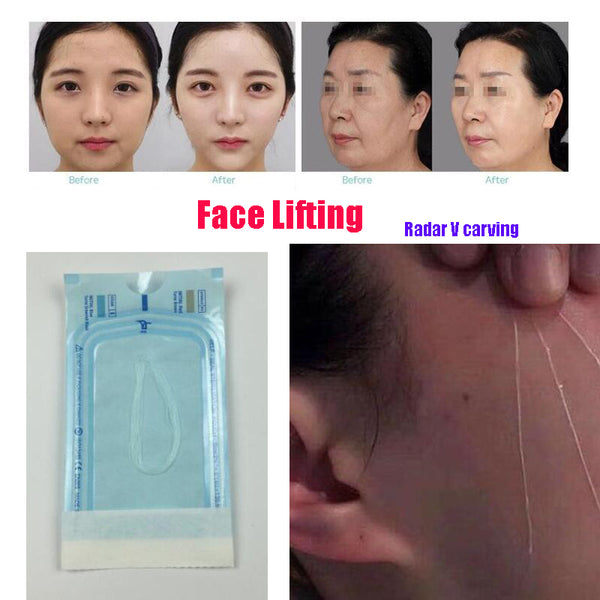 Radar Thread No Needle Silk Fibroin Line Carving Essence Collagen Facial Thread Lift Anti Aging Hyaluronic Tightening Skin Care
