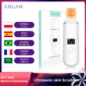 ANLAN Ultrasonic Cleaner 45°C Heat Ultrasonic Skin Scrubber Deep Face Cleaning Machine Shovel Skin Care Face Lift Peeling Facial